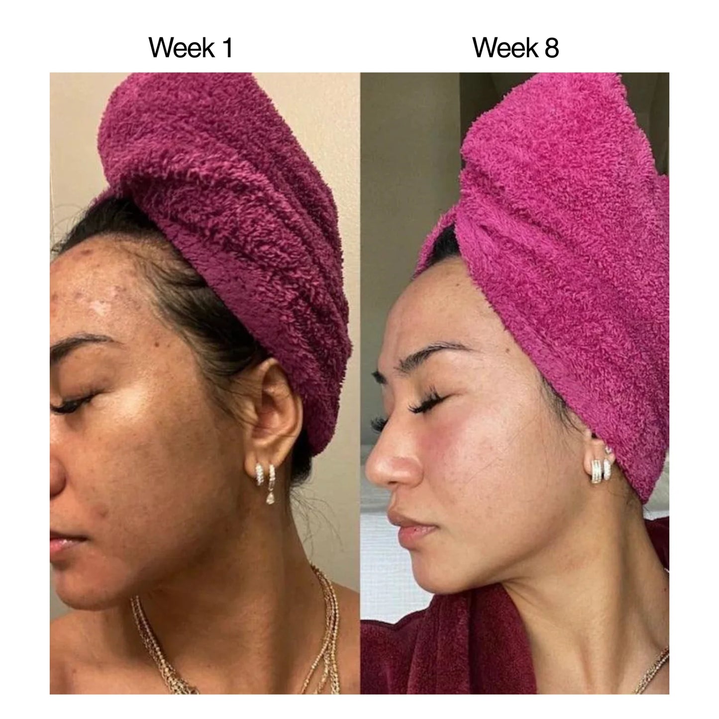 Turmeric Brightening Soap