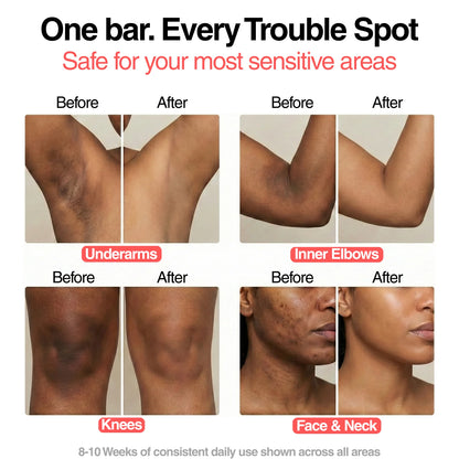 Turmeric Brightening Soap